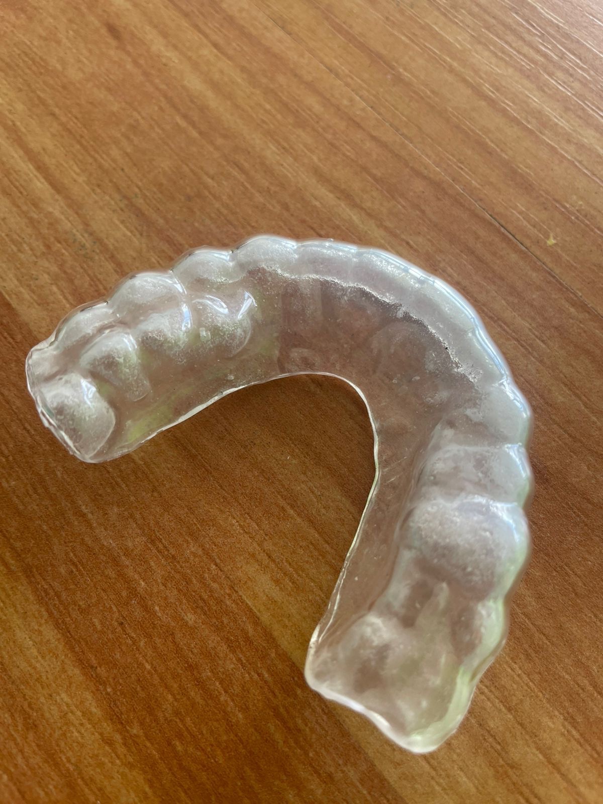 Servicio de ortodoncia invisible